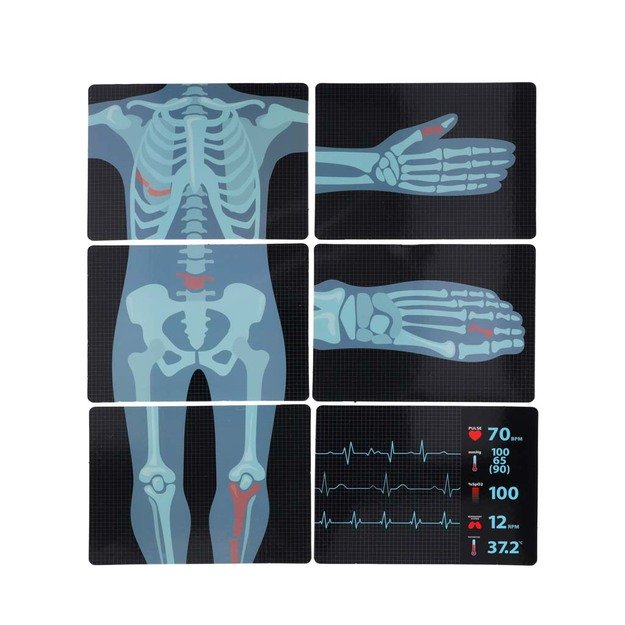 Didelis gydytojo rinkinys medicininė stotis mažas gydytojas ekg rentgeno &scaron;viesa garsas 11